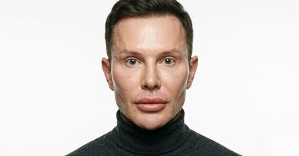 Se buscan hombres entre 40 y 65 años con cirugías faciales para spot publicitario